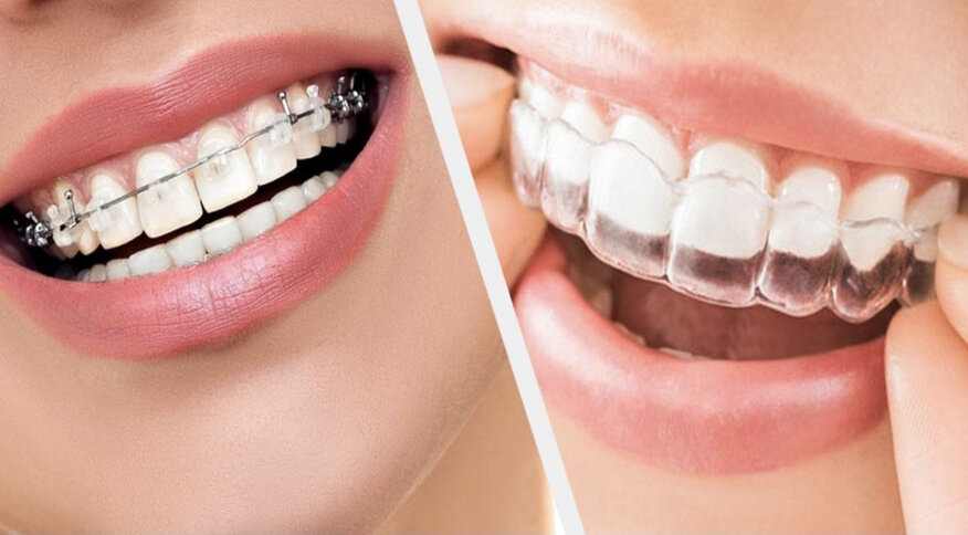 Cosmetic Dentistry